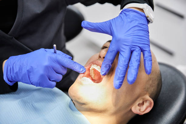 Best Emergency Treatment for Oral Infections in Bay City, TX